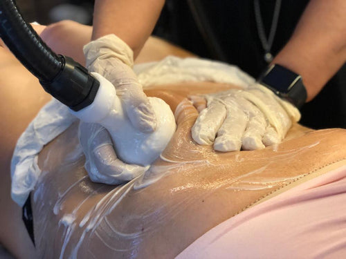 cryolipolyse corps soin par le froid